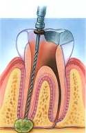 endodontics